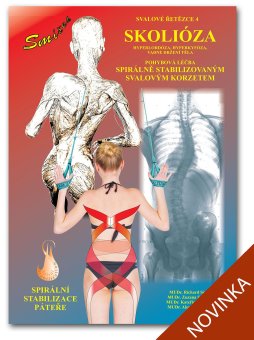 Kniha Skolióza