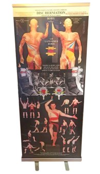 Roll-up banner- Hernia disku