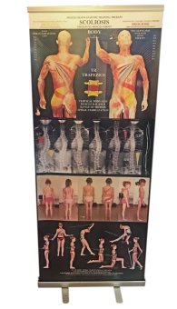 Roll-up banner- Skolióza
